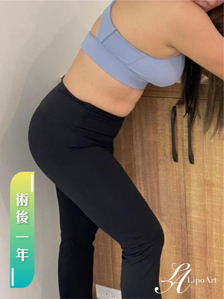 萊波亞