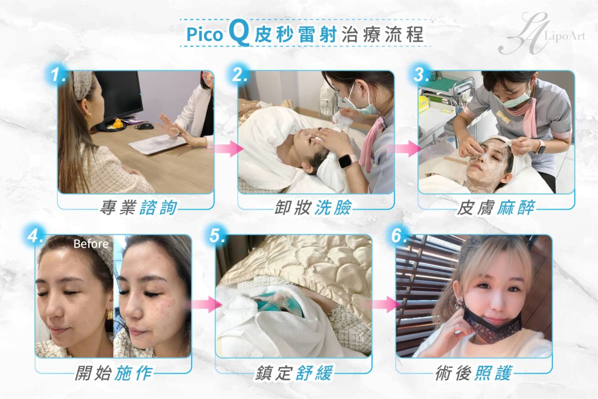 萊波亞