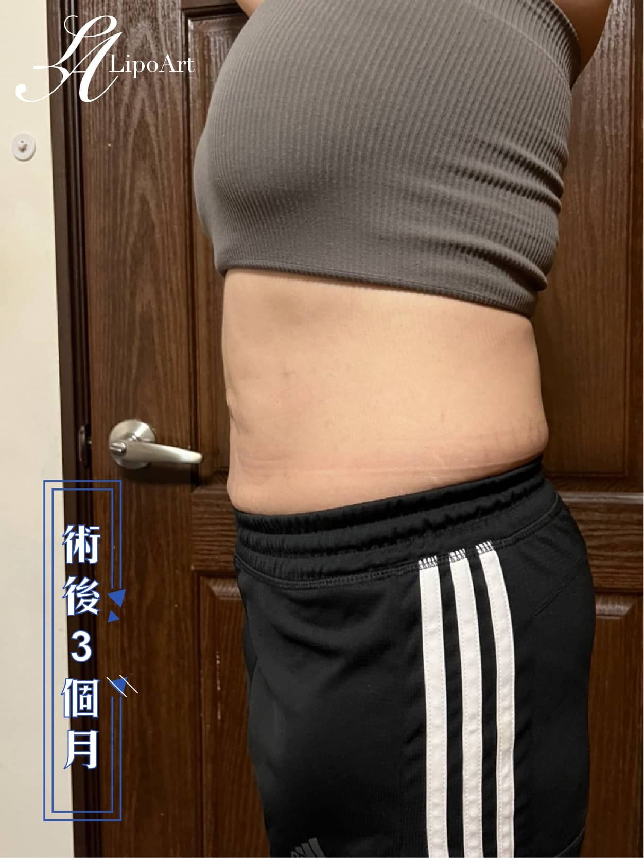 萊波亞