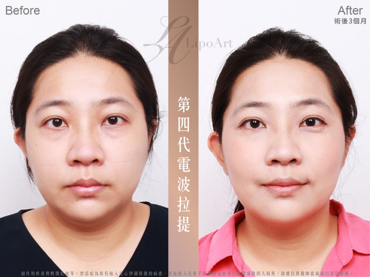 萊波亞