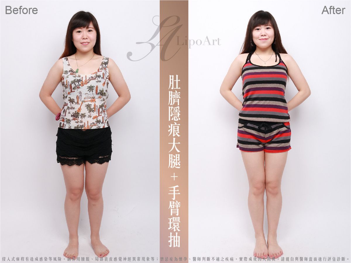 萊波亞