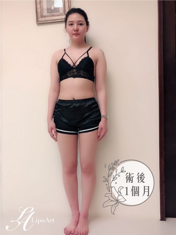 萊波亞