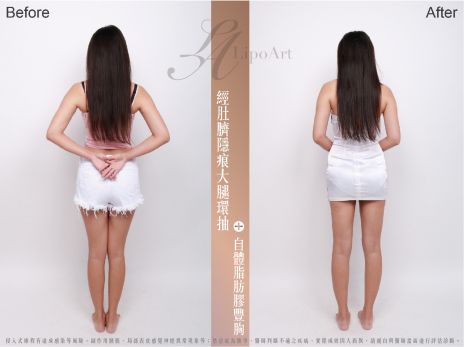 萊波亞 