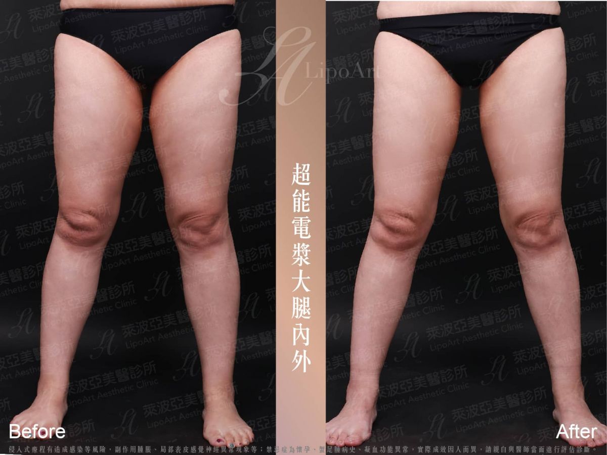 萊波亞