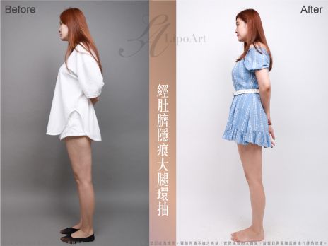 萊波亞 