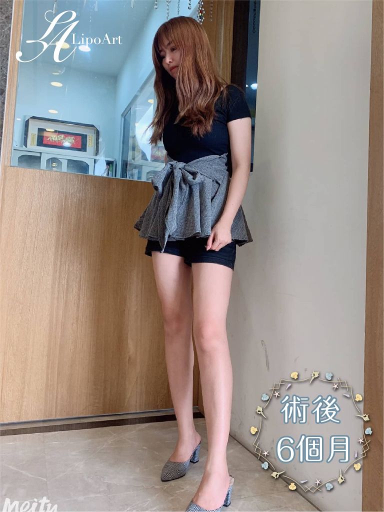 萊波亞