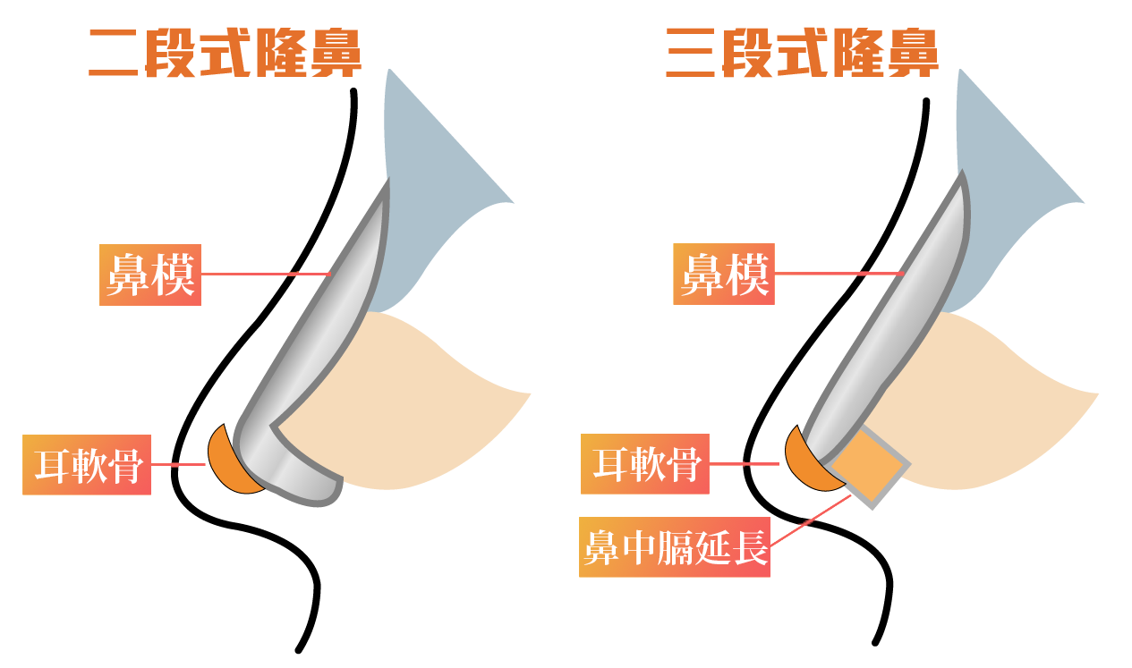 萊波亞