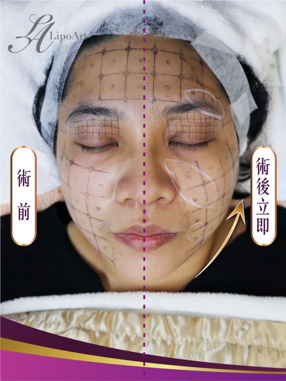萊波亞