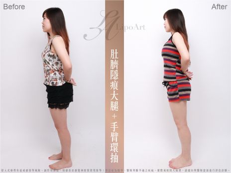 萊波亞