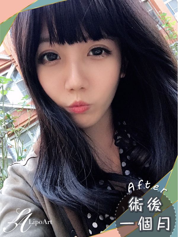 萊波亞