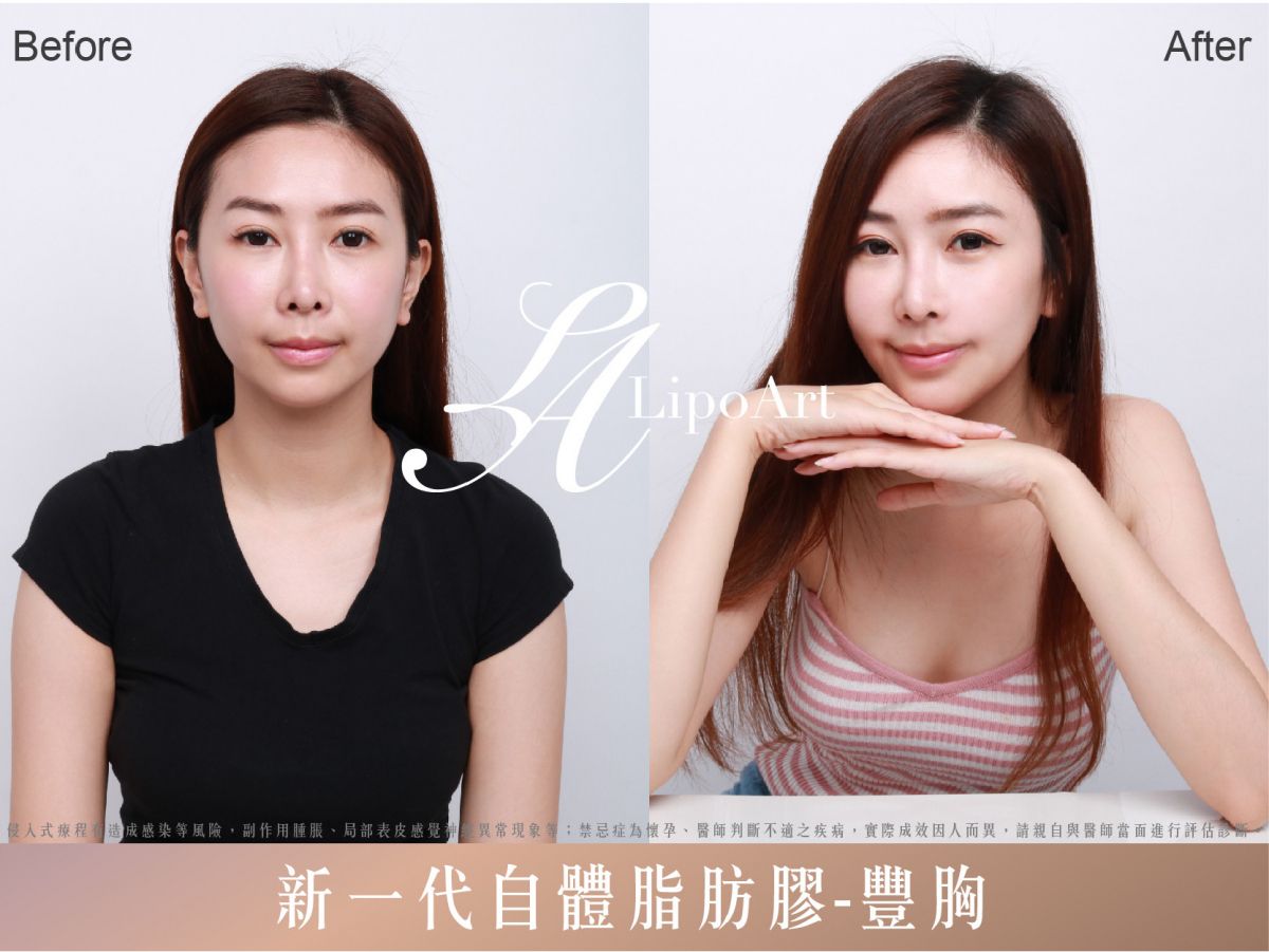 萊波亞