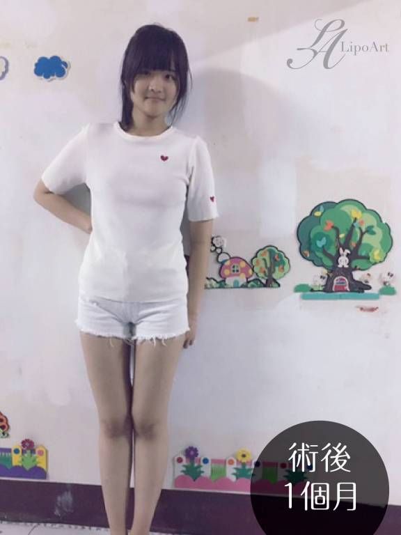 萊波亞