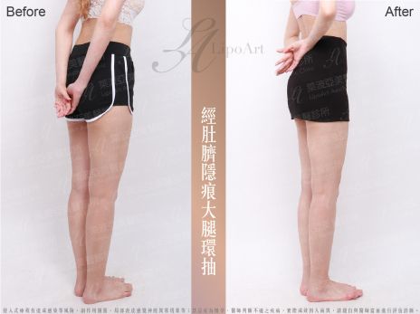 萊波亞