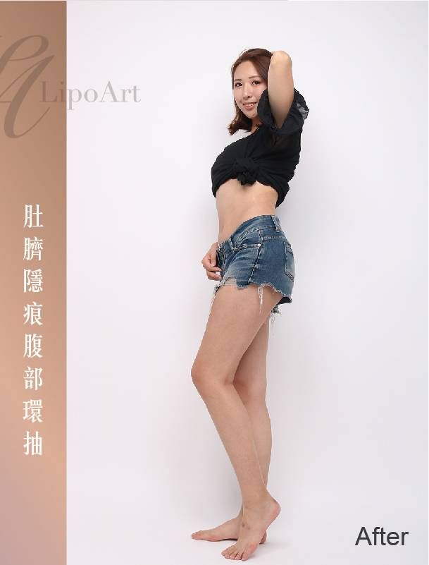 萊波亞