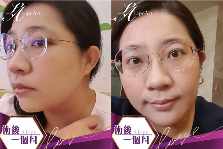 萊波亞