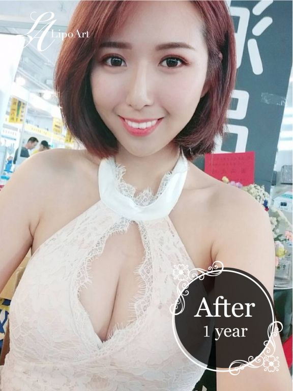 萊波亞