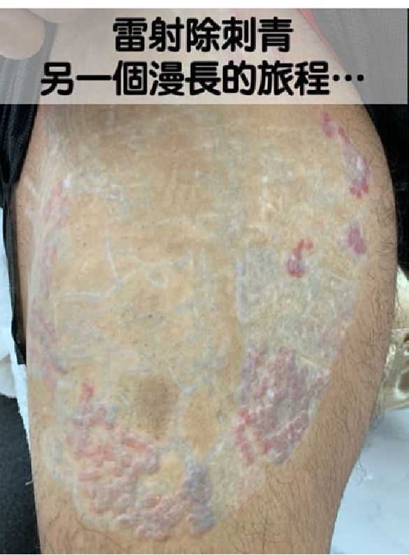 萊波亞