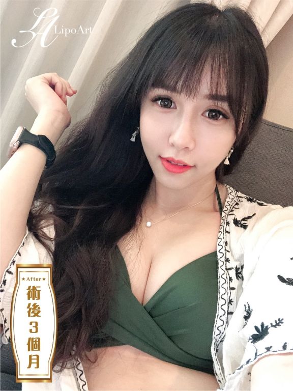 萊波亞
