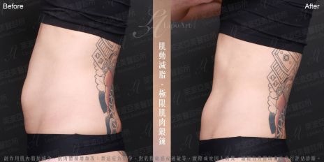 萊波亞 