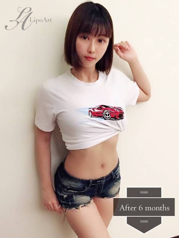 萊波亞