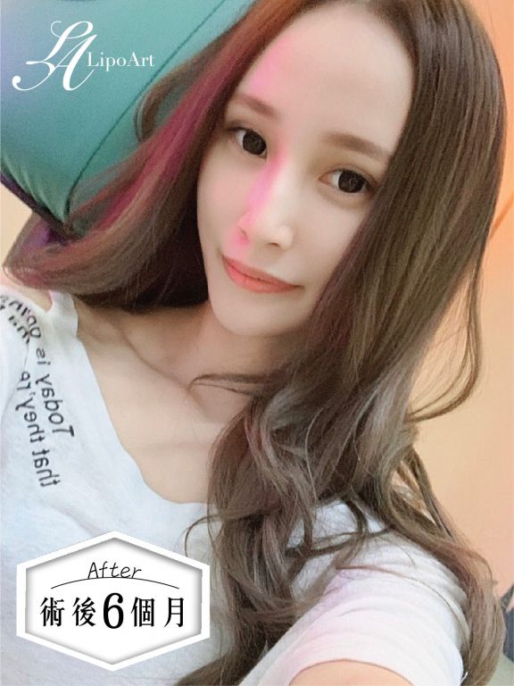 萊波亞
