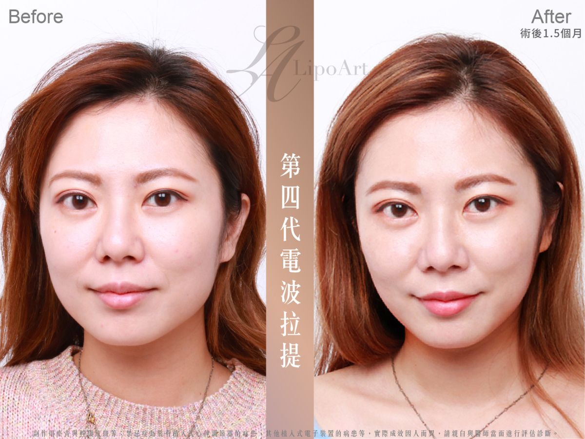 萊波亞