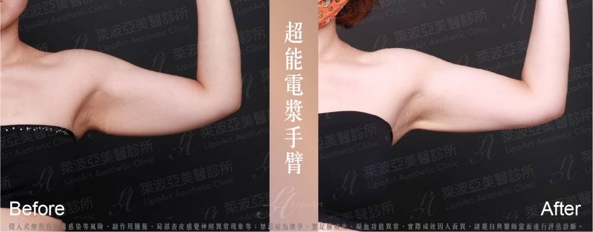 萊波亞