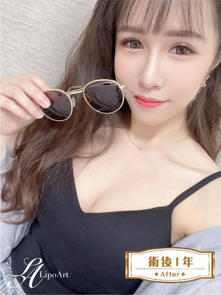 萊波亞
