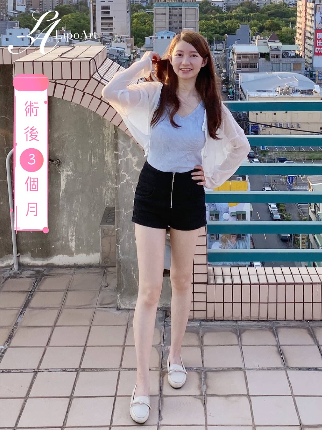 萊波亞
