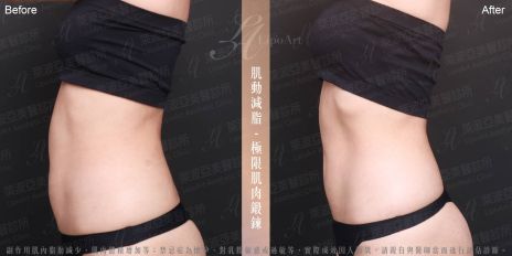 萊波亞