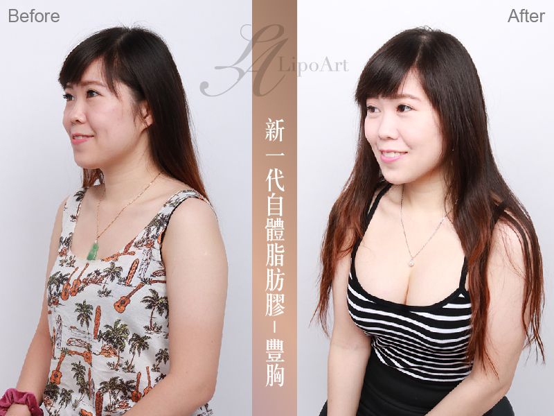 萊波亞
