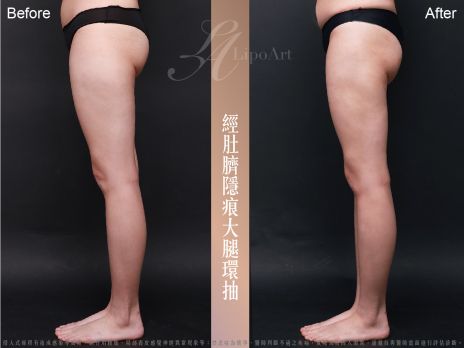 萊波亞 
