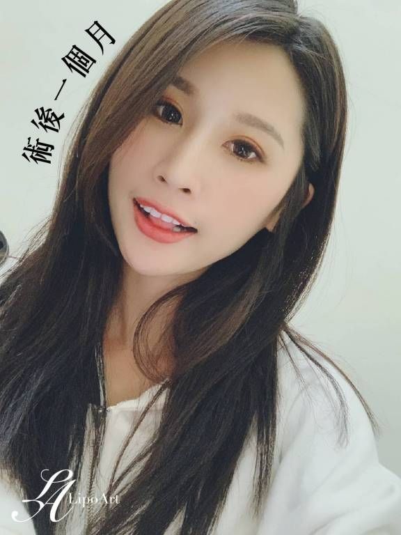 萊波亞
