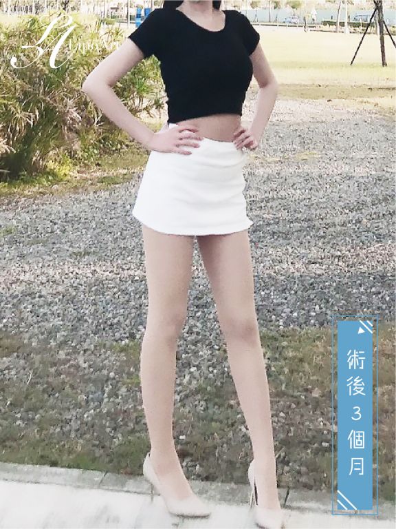 萊波亞