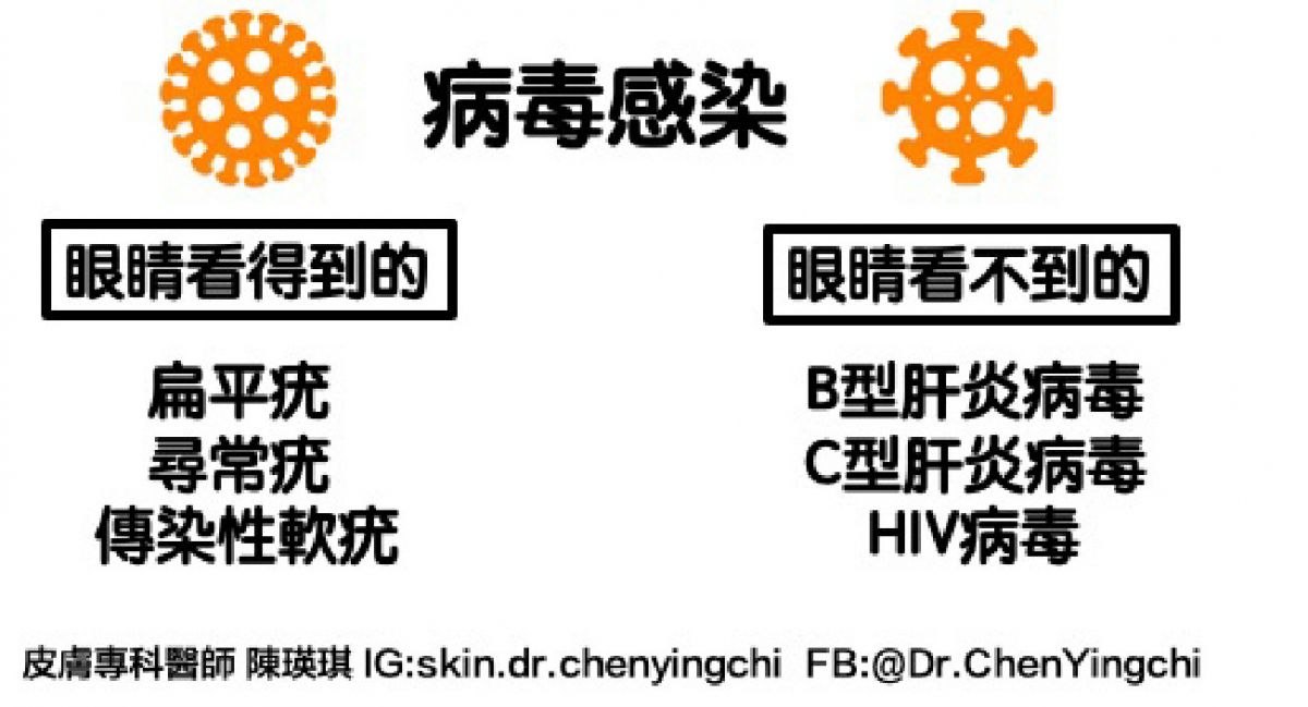 萊波亞