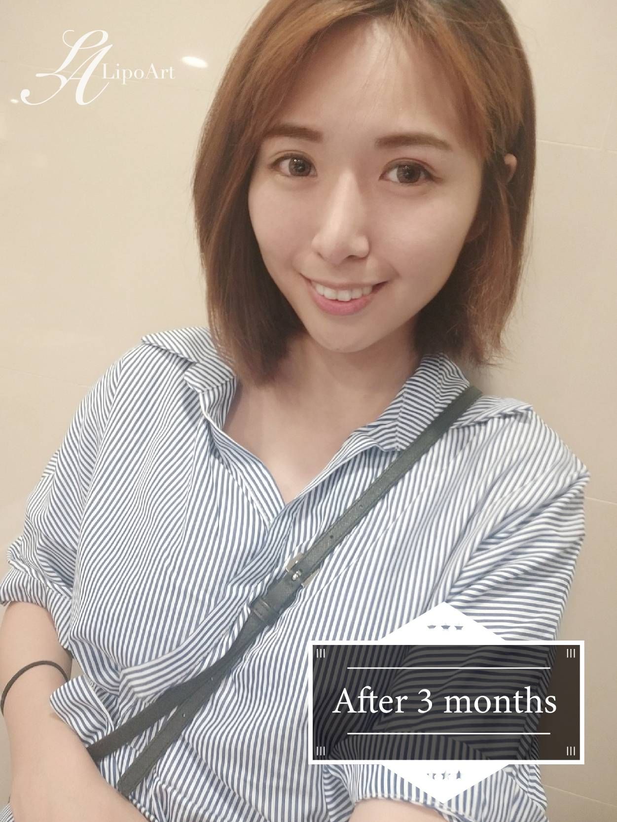 萊波亞
