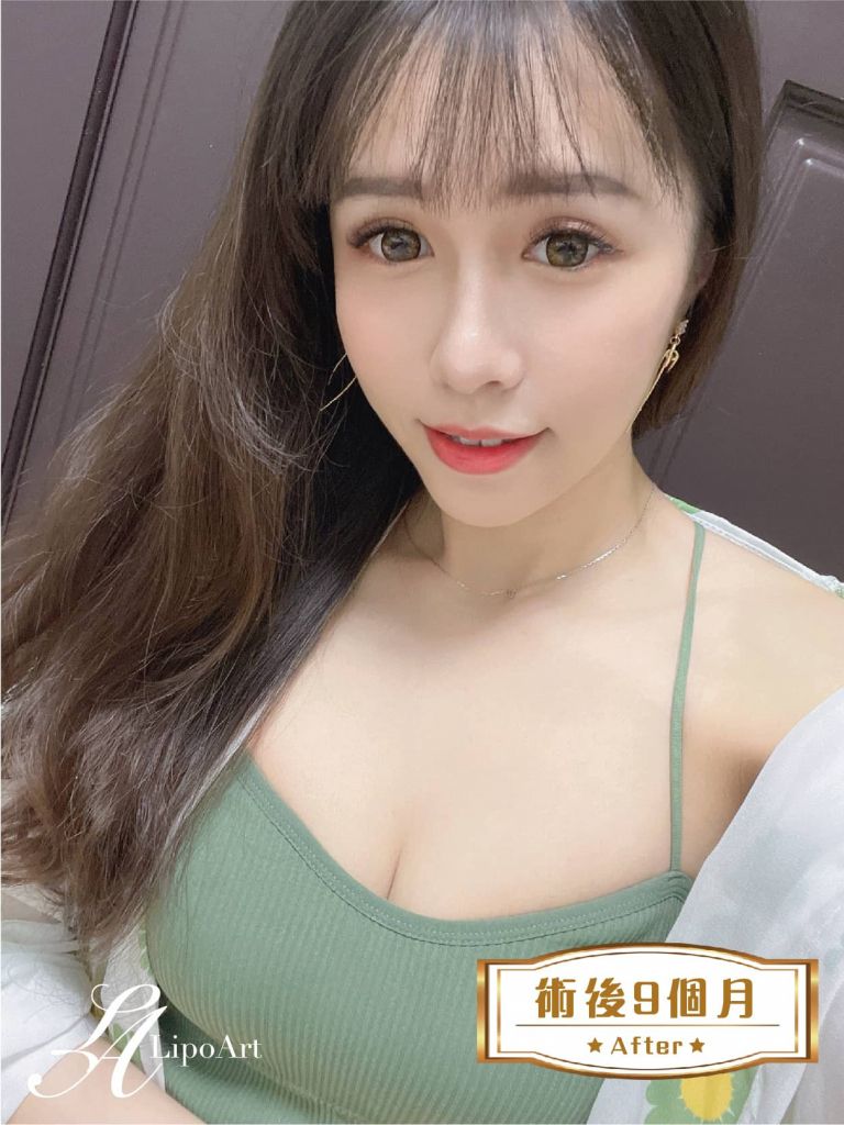 萊波亞