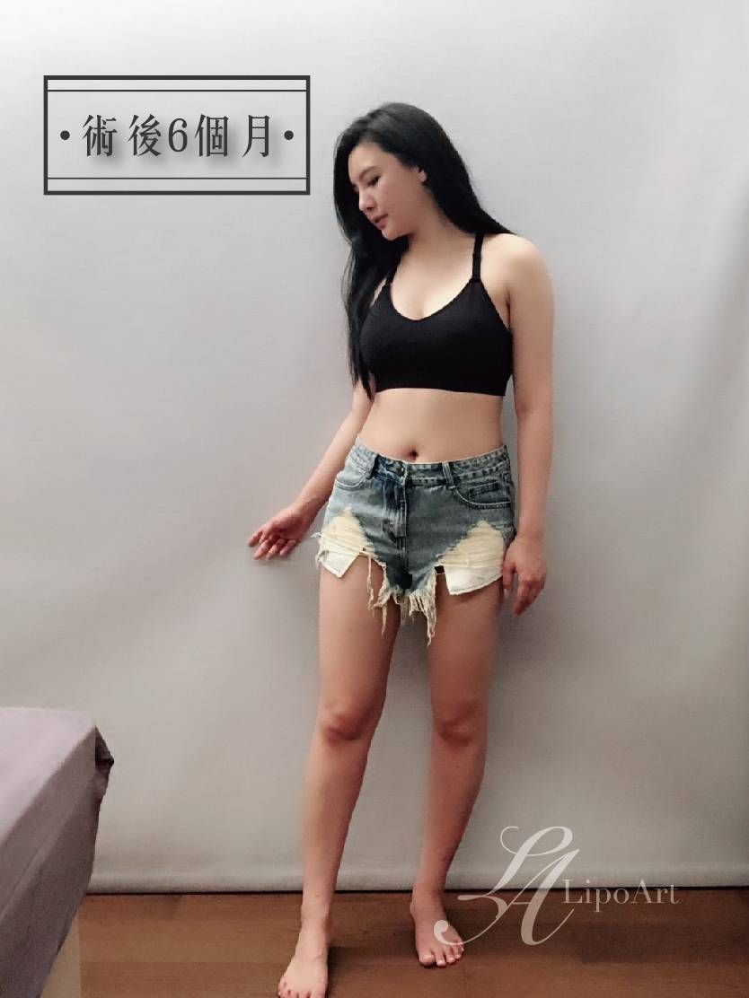 萊波亞 