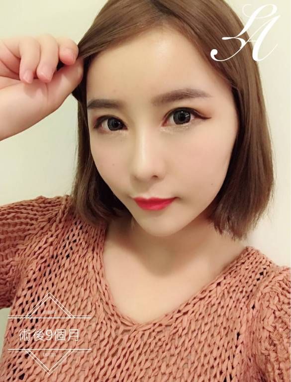 萊波亞