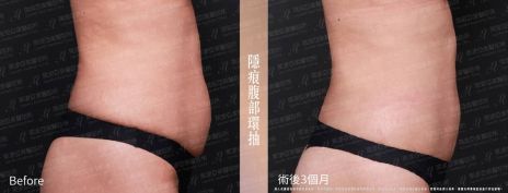 萊波亞 