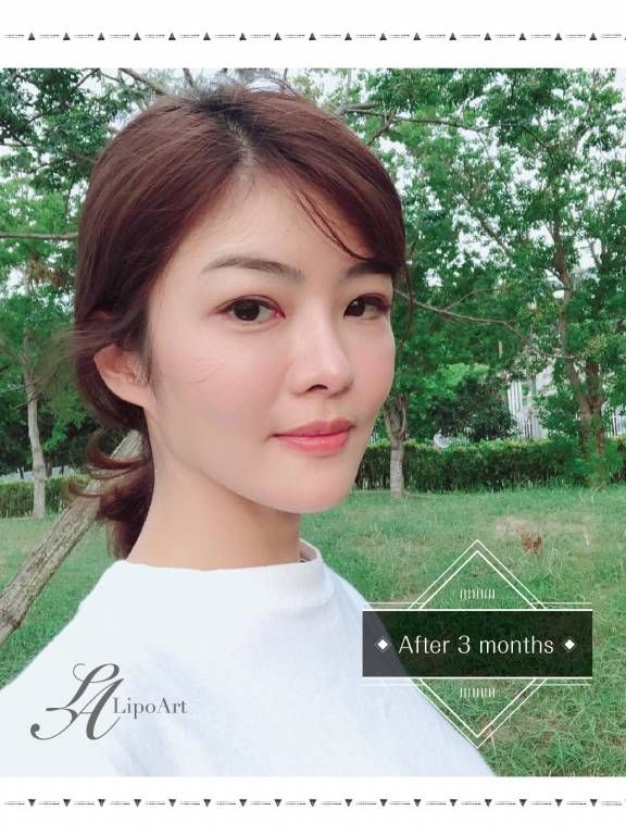 萊波亞