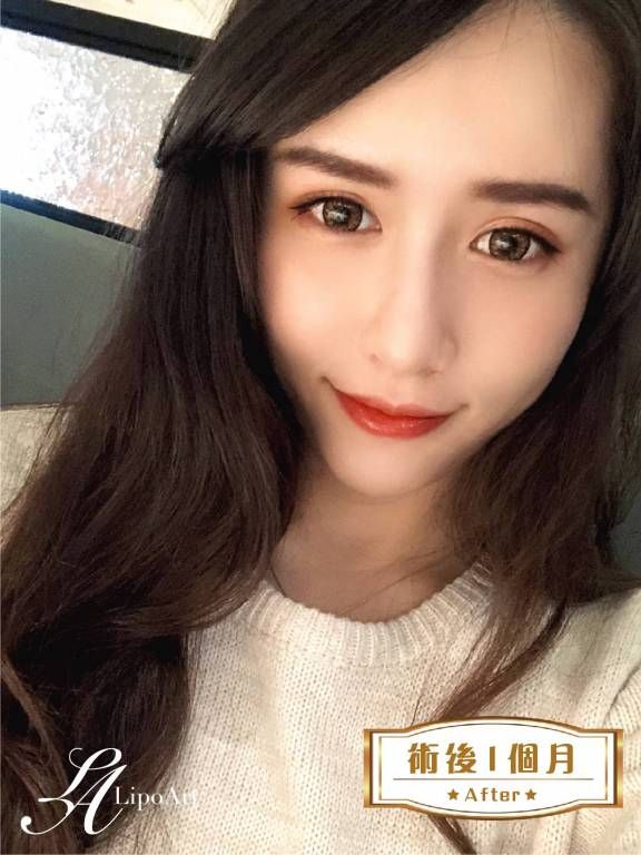 萊波亞