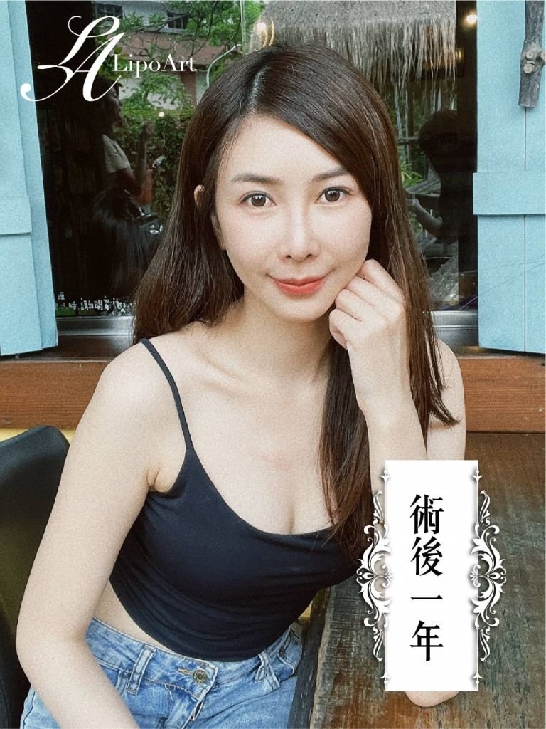 萊波亞
