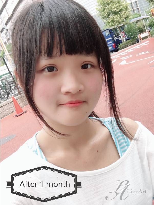 萊波亞
