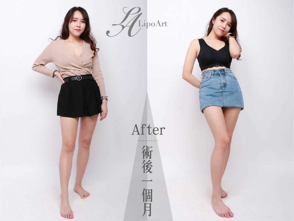 萊波亞
