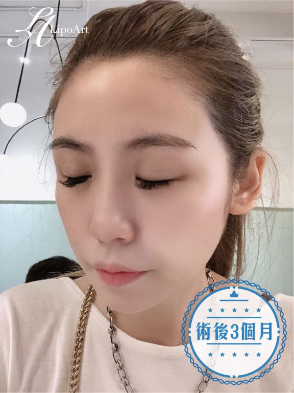 萊波亞