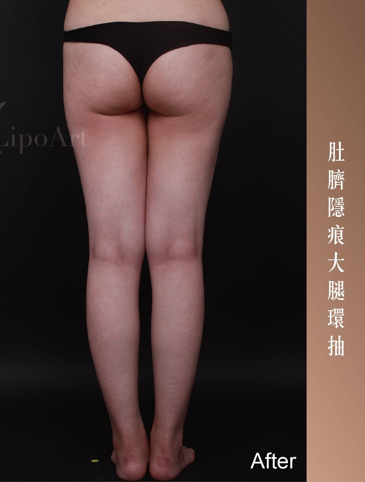萊波亞 