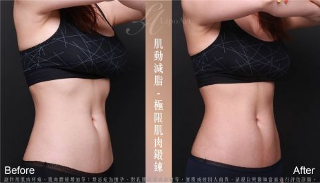 萊波亞 