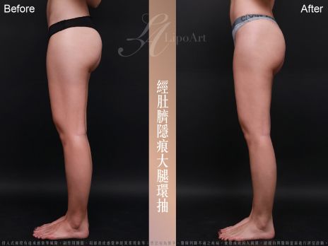 萊波亞 