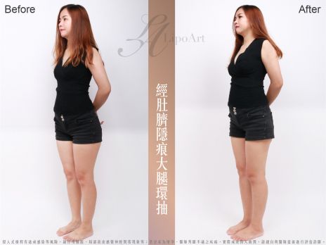 萊波亞 